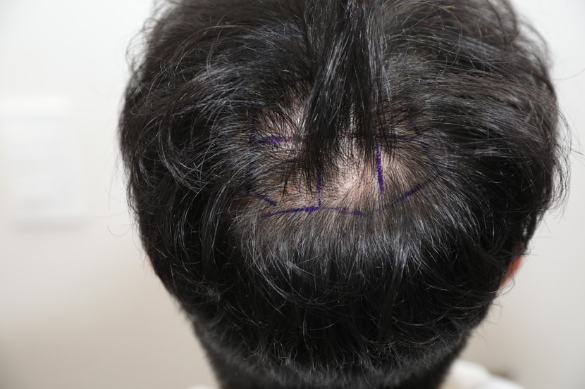 b69bc331a569b487e7985c20a1b21d65_1760543050_3681.jpg b69bc331a569b487e7985c20a1b21d65_1760543050_3681.jpg