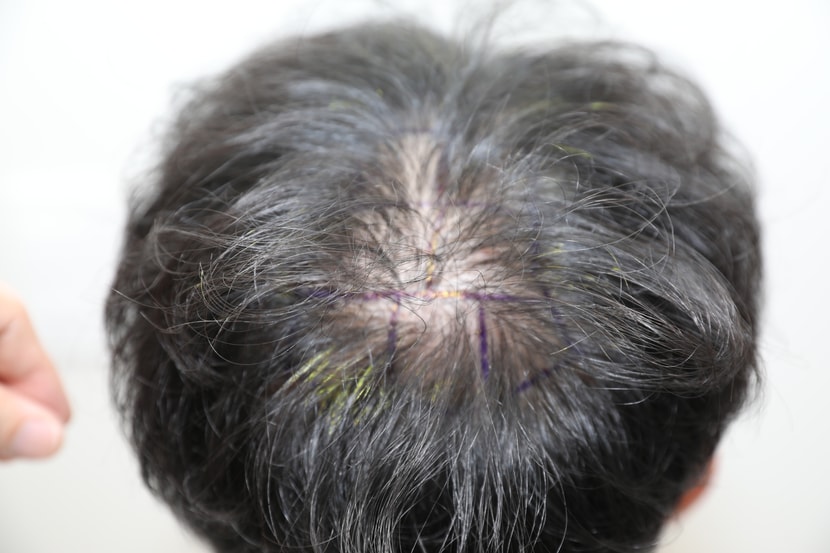 b69bc331a569b487e7985c20a1b21d65_1760543055_3944.jpg b69bc331a569b487e7985c20a1b21d65_1760543055_3944.jpg