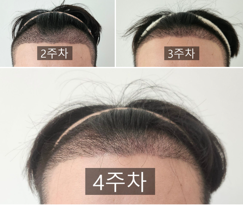 포토후기 이미지