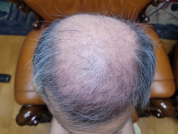 f45581df729d5d51f09a1d0615cf7d93_1761031192_1103.jpg f45581df729d5d51f09a1d0615cf7d93_1761031192_1103.jpg