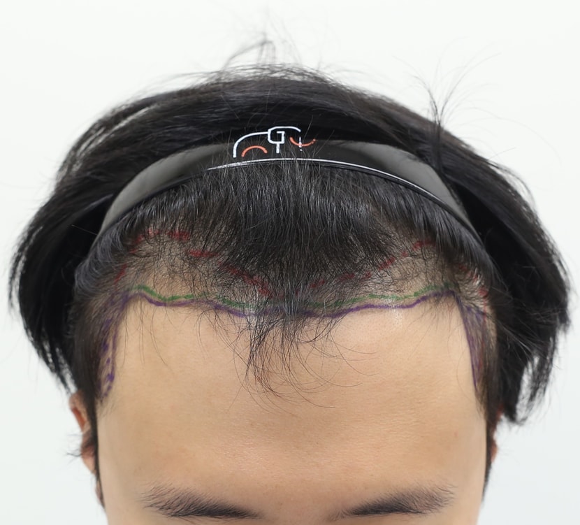 0eb02da92445da0b811cbf05c975e015_1763468805_3946.jpg 0eb02da92445da0b811cbf05c975e015_1763468805_3946.jpg