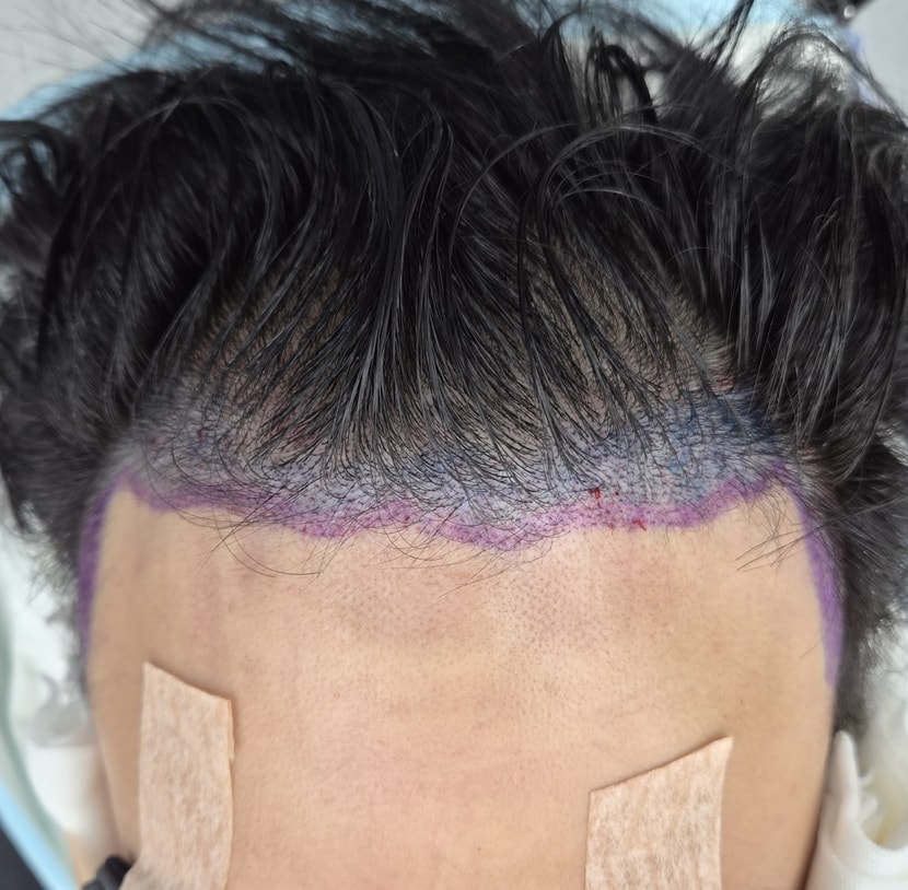 0eb02da92445da0b811cbf05c975e015_1763468805_5756.jpg 0eb02da92445da0b811cbf05c975e015_1763468805_5756.jpg