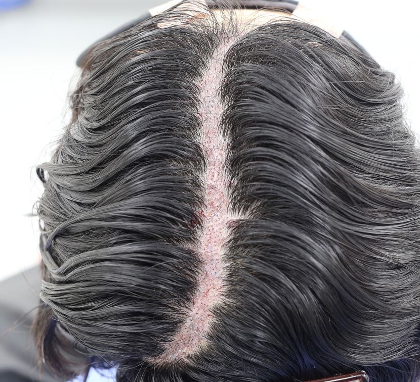 138117c0cad1f1cfb79acea9fe18e3b9_1761975736_9921.jpeg 138117c0cad1f1cfb79acea9fe18e3b9_1761975736_9921.jpeg