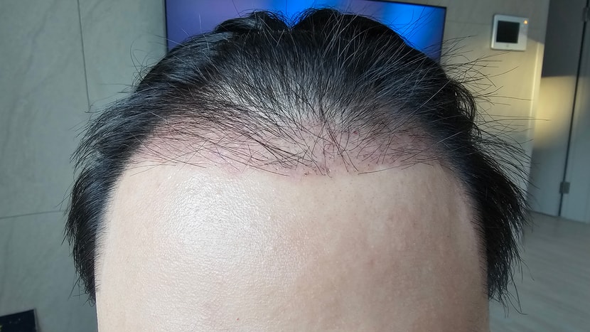 28c7e7c10168ce18a2345de6e3a02d11_1764049101_8032.jpg 28c7e7c10168ce18a2345de6e3a02d11_1764049101_8032.jpg