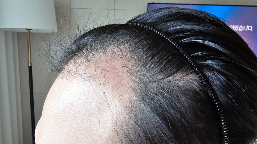 28c7e7c10168ce18a2345de6e3a02d11_1764049102_458.jpg 28c7e7c10168ce18a2345de6e3a02d11_1764049102_458.jpg