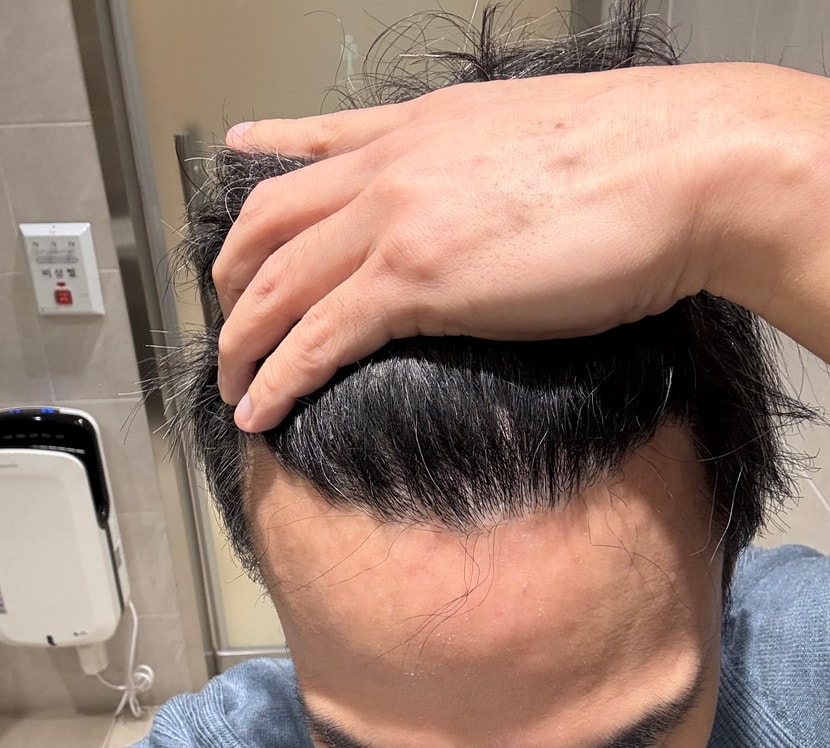 30fd7690201ad2b13b434c2a2347f590_1764202587_8883.jpg 30fd7690201ad2b13b434c2a2347f590_1764202587_8883.jpg