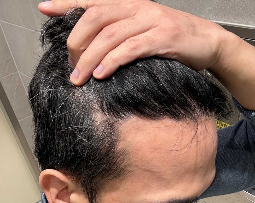 30fd7690201ad2b13b434c2a2347f590_1764202588_6089.jpg 30fd7690201ad2b13b434c2a2347f590_1764202588_6089.jpg