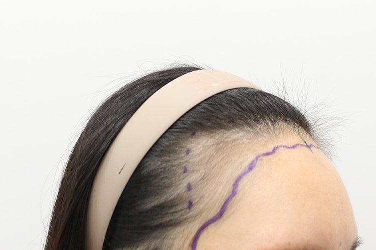 4c4fe2103dbfa6580333dec696574810_1762933095_3314.jpg 4c4fe2103dbfa6580333dec696574810_1762933095_3314.jpg