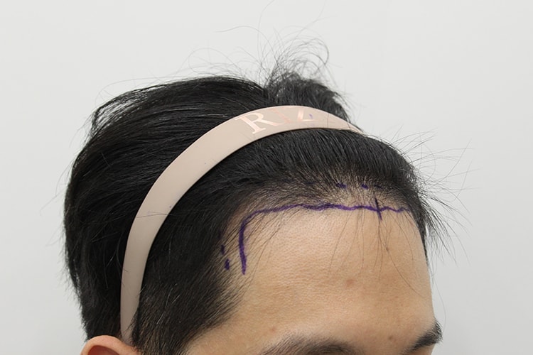 5675fa5afc3d187fdccc7d886ec49d74_1762327663_3524.jpg 5675fa5afc3d187fdccc7d886ec49d74_1762327663_3524.jpg