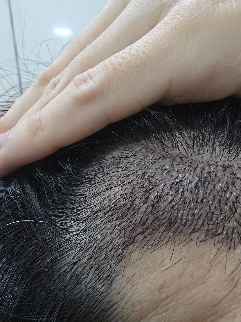 8be5be0a564890d01cc04ea8d69441b5_1763215077_6367.jpg 8be5be0a564890d01cc04ea8d69441b5_1763215077_6367.jpg