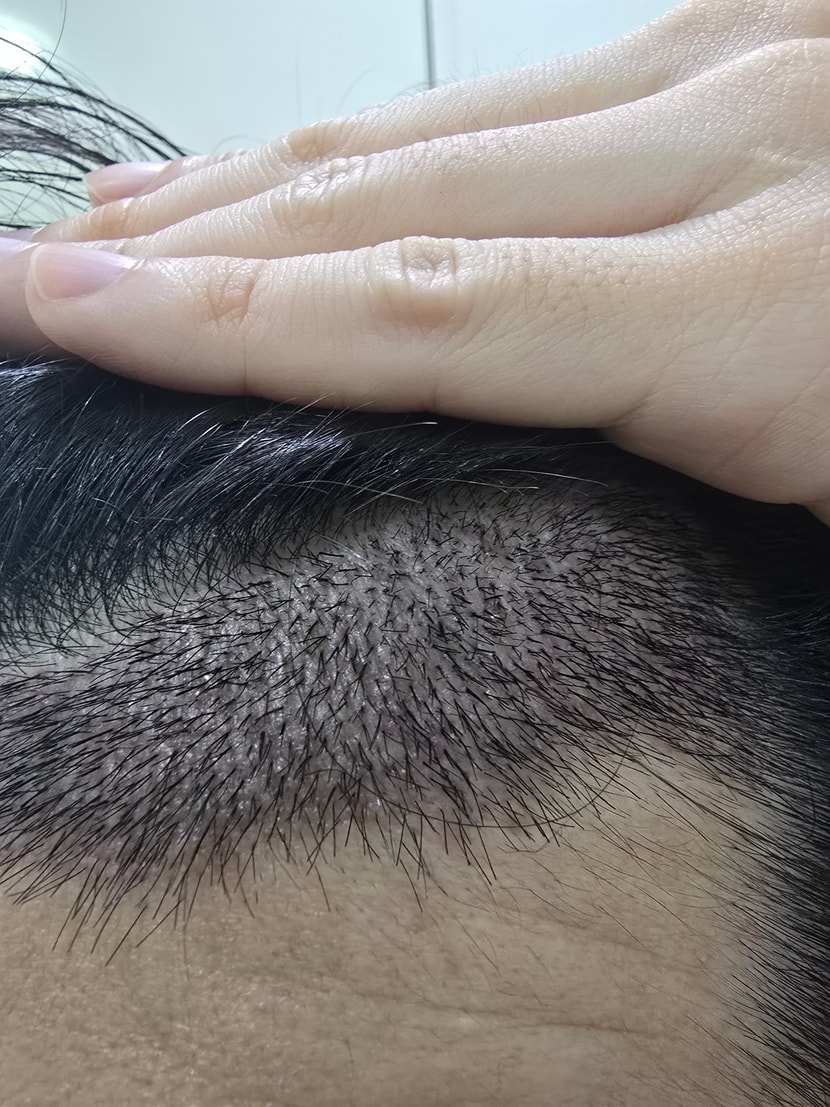 8be5be0a564890d01cc04ea8d69441b5_1763215078_2296.jpg 8be5be0a564890d01cc04ea8d69441b5_1763215078_2296.jpg