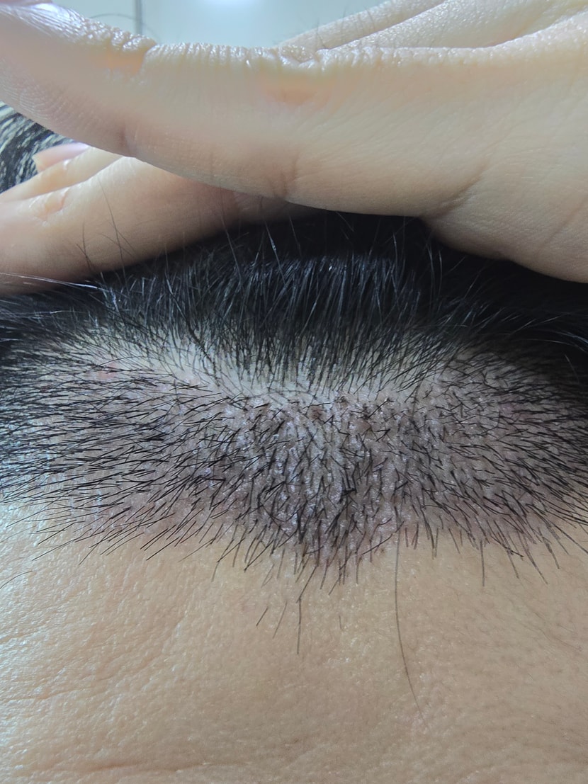 8be5be0a564890d01cc04ea8d69441b5_1763215078_6749.jpg 8be5be0a564890d01cc04ea8d69441b5_1763215078_6749.jpg