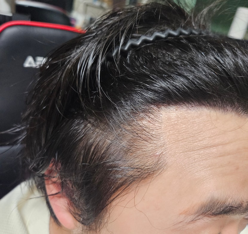 8be5be0a564890d01cc04ea8d69441b5_1763306167_208.jpg 8be5be0a564890d01cc04ea8d69441b5_1763306167_208.jpg