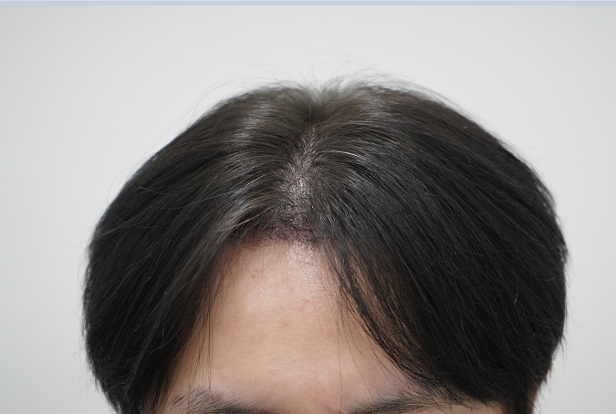 92de81c3032e3770b349ff017afd7f8c_1764310580_5083.png 92de81c3032e3770b349ff017afd7f8c_1764310580_5083.png