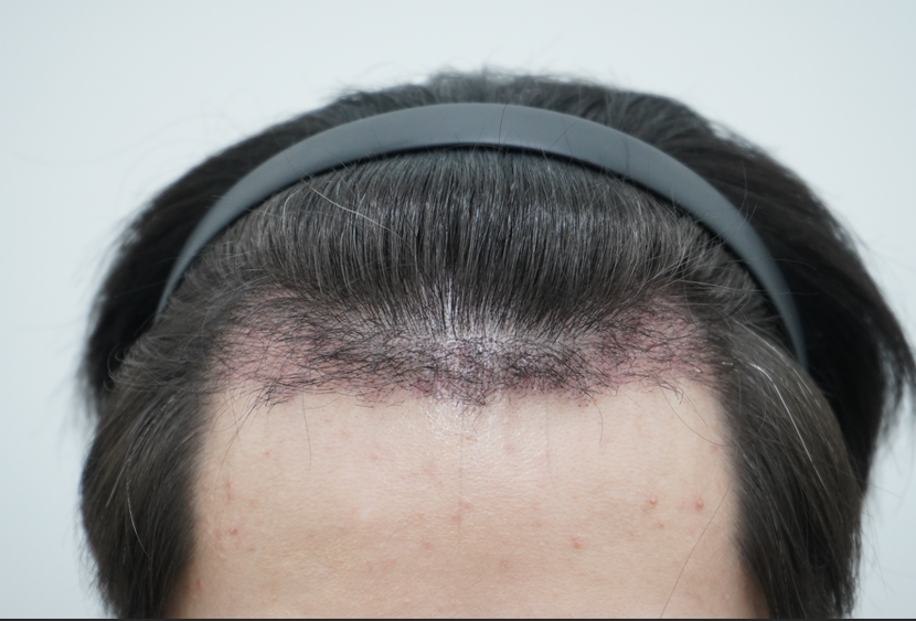 92de81c3032e3770b349ff017afd7f8c_1764310580_919.png 92de81c3032e3770b349ff017afd7f8c_1764310580_919.png