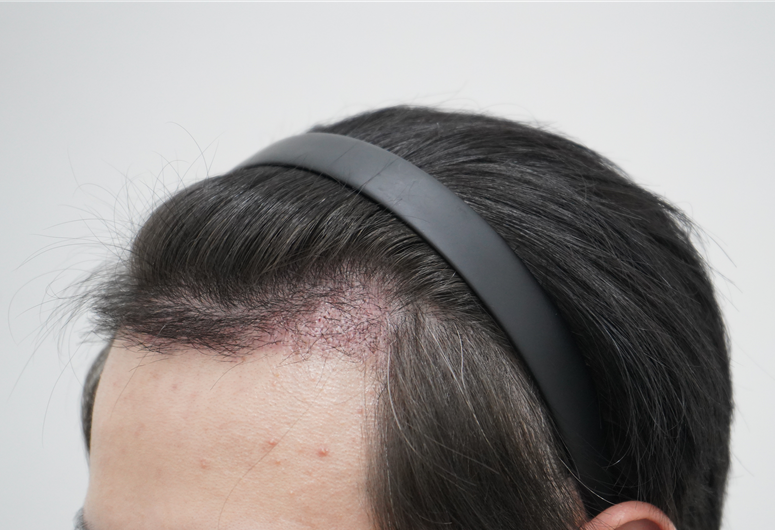 92de81c3032e3770b349ff017afd7f8c_1764310581_0916.png 92de81c3032e3770b349ff017afd7f8c_1764310581_0916.png