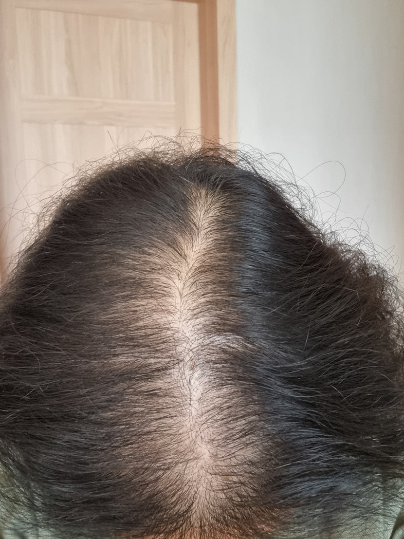 9de1720085e2dd15e31510d8d5baf950_1762485995_9503.jpg 9de1720085e2dd15e31510d8d5baf950_1762485995_9503.jpg