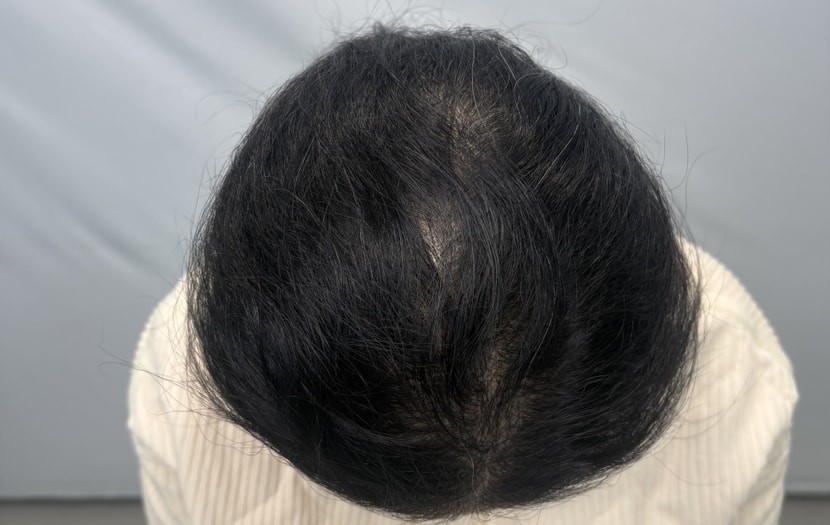 9de1720085e2dd15e31510d8d5baf950_1762485997_3647.jpeg 9de1720085e2dd15e31510d8d5baf950_1762485997_3647.jpeg