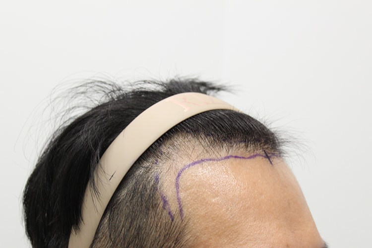 d4956b63b2d362e36864306f8ffc88dc_1764319140_5716.jpg d4956b63b2d362e36864306f8ffc88dc_1764319140_5716.jpg