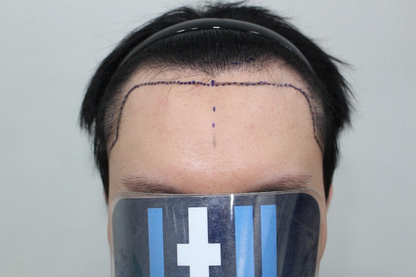 dc7689b9d2b39d967f35d0a724211759_1763265078_1557.jpg dc7689b9d2b39d967f35d0a724211759_1763265078_1557.jpg