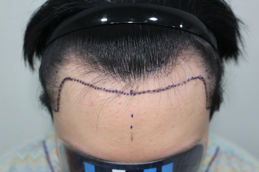 dc7689b9d2b39d967f35d0a724211759_1763265078_5992.jpg dc7689b9d2b39d967f35d0a724211759_1763265078_5992.jpg