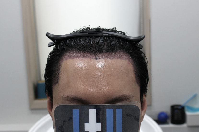 dc7689b9d2b39d967f35d0a724211759_1763265093_6052.jpg dc7689b9d2b39d967f35d0a724211759_1763265093_6052.jpg