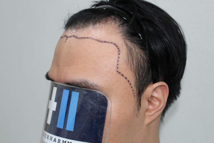 dd9ff614695e5eccd6a826a96ebb833e_1763208231_6535.jpg dd9ff614695e5eccd6a826a96ebb833e_1763208231_6535.jpg