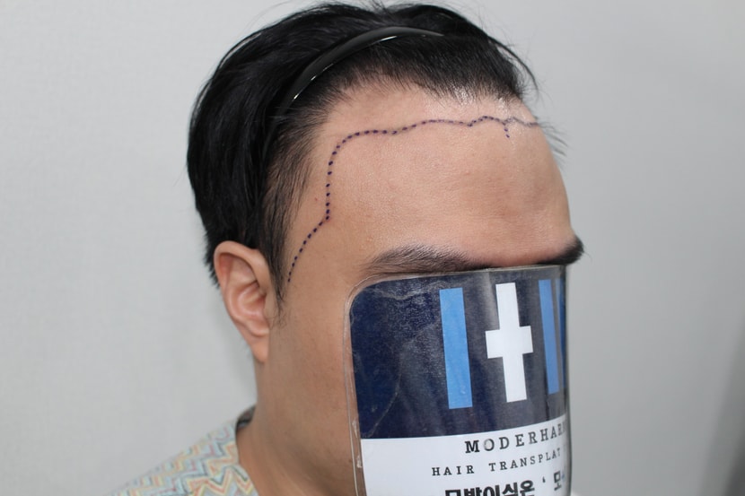 dd9ff614695e5eccd6a826a96ebb833e_1763208231_794.jpg dd9ff614695e5eccd6a826a96ebb833e_1763208231_794.jpg