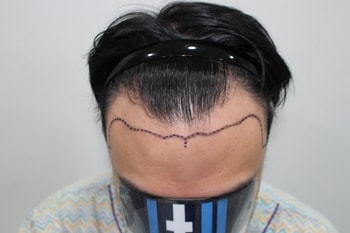 dd9ff614695e5eccd6a826a96ebb833e_1763208231_9672.jpg dd9ff614695e5eccd6a826a96ebb833e_1763208231_9672.jpg