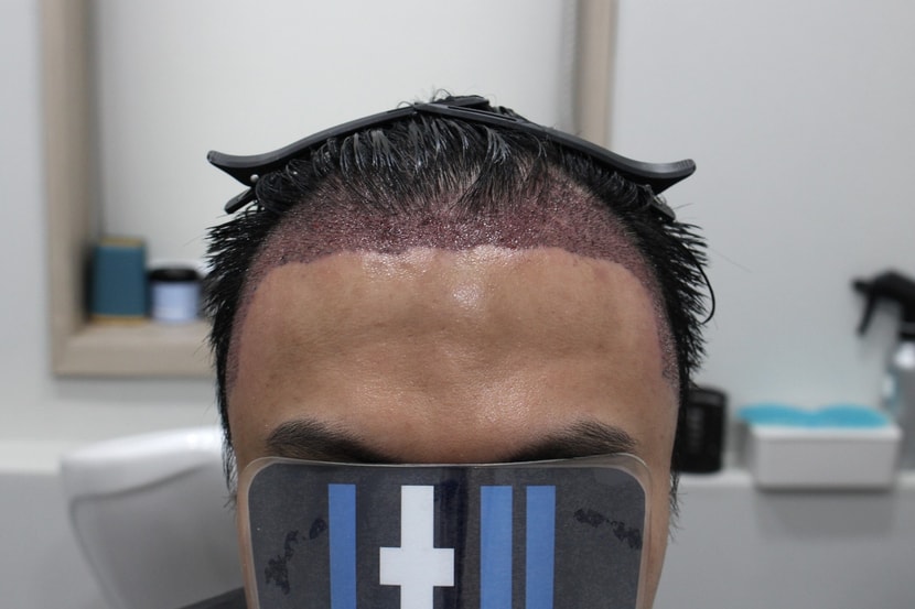 dd9ff614695e5eccd6a826a96ebb833e_1763208233_5334.jpg dd9ff614695e5eccd6a826a96ebb833e_1763208233_5334.jpg