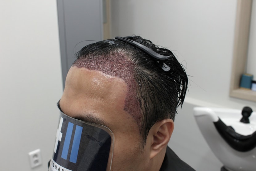 dd9ff614695e5eccd6a826a96ebb833e_1763208233_6632.jpg dd9ff614695e5eccd6a826a96ebb833e_1763208233_6632.jpg