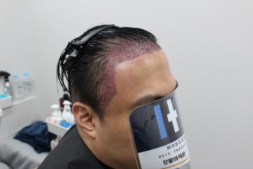 dd9ff614695e5eccd6a826a96ebb833e_1763208233_7972.jpg dd9ff614695e5eccd6a826a96ebb833e_1763208233_7972.jpg