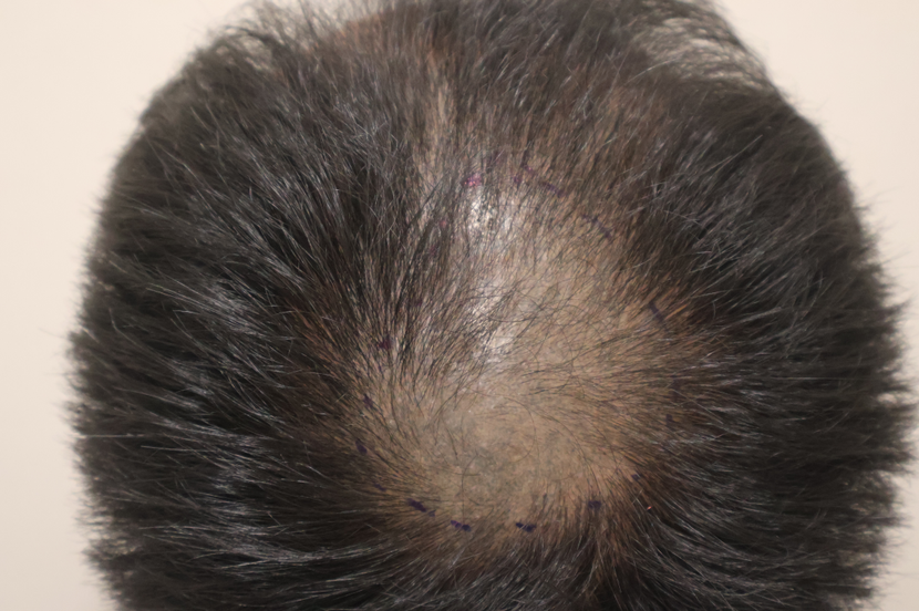 eb0f5dd81981230e2d1f08900438e801_1762218269_2954.png eb0f5dd81981230e2d1f08900438e801_1762218269_2954.png