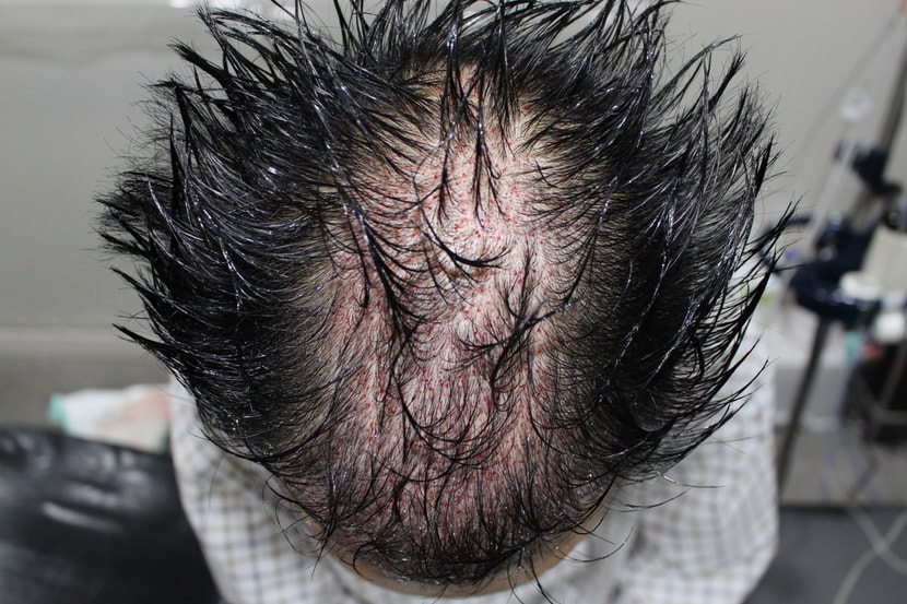 41f1bac0d996adef349c72f97e74e57b_1765711627_1878.jpg 41f1bac0d996adef349c72f97e74e57b_1765711627_1878.jpg