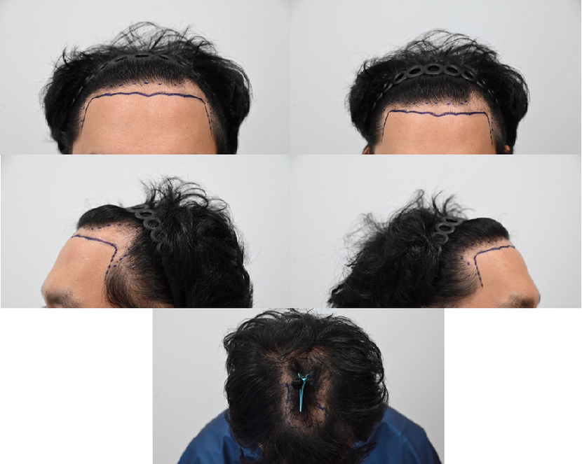 7d180e64e4e3ebae22325024f22e8df7_1764662712_0187.png 7d180e64e4e3ebae22325024f22e8df7_1764662712_0187.png