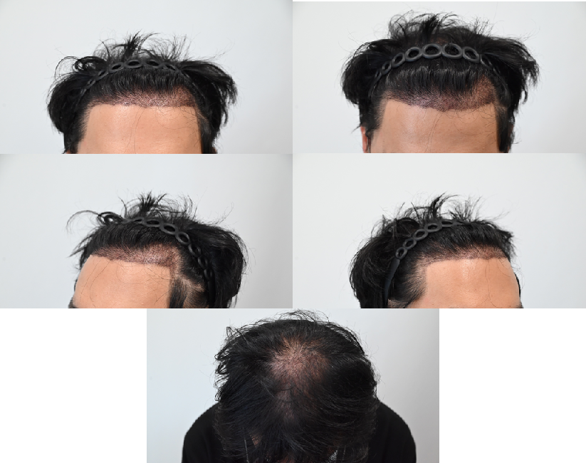 7d180e64e4e3ebae22325024f22e8df7_1764662843_8323.png 7d180e64e4e3ebae22325024f22e8df7_1764662843_8323.png