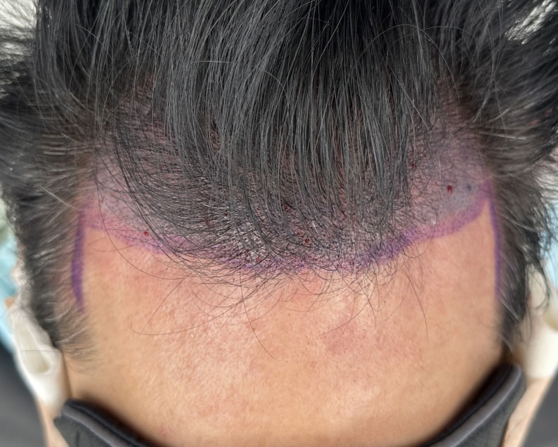 be4ed518825276704223bfa86943b813_1765630763_8713.jpg be4ed518825276704223bfa86943b813_1765630763_8713.jpg