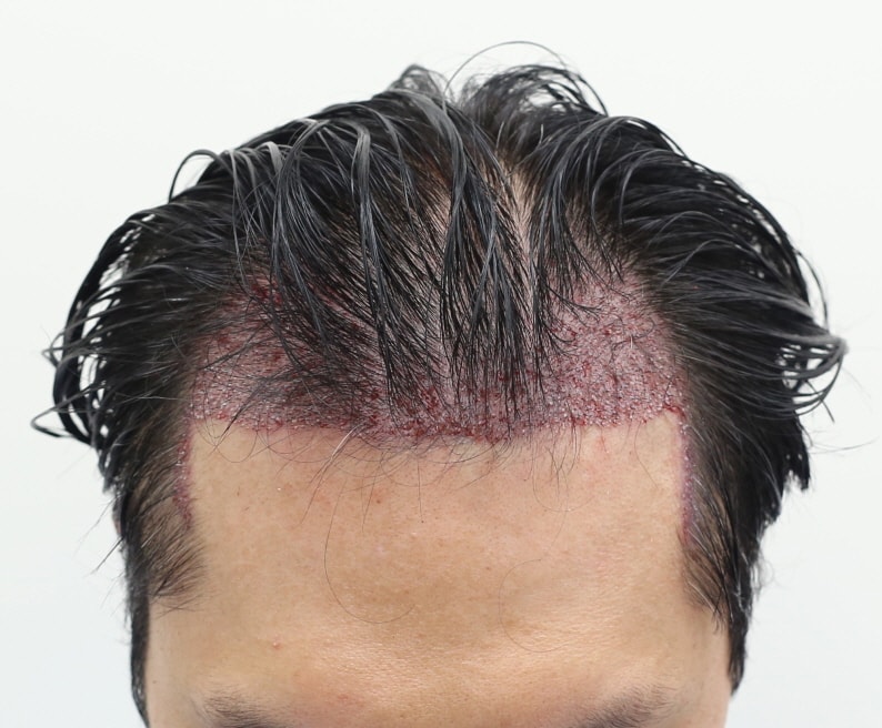 be4ed518825276704223bfa86943b813_1765630764_0879.jpg be4ed518825276704223bfa86943b813_1765630764_0879.jpg