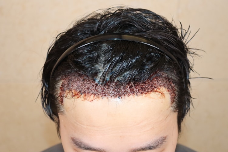 d8d5ada4ebfe1d60631d6f26b68f5041_1764819452_6339.jpg d8d5ada4ebfe1d60631d6f26b68f5041_1764819452_6339.jpg