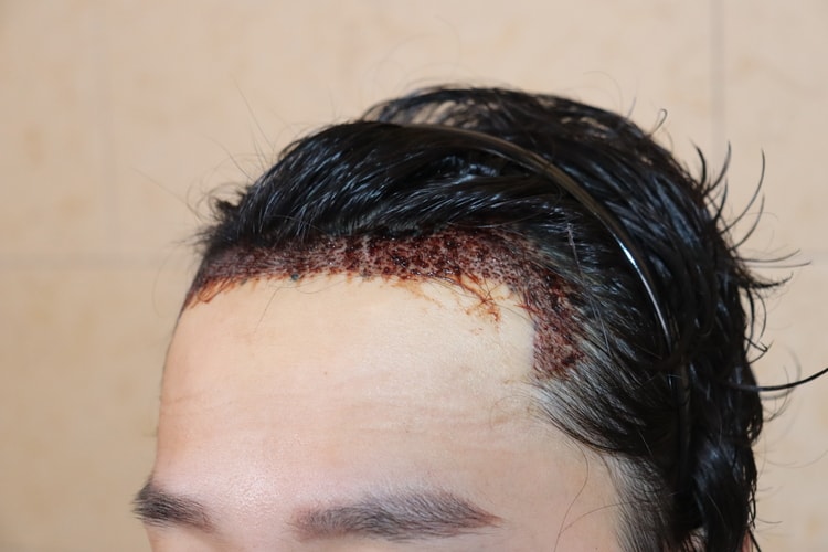 d8d5ada4ebfe1d60631d6f26b68f5041_1764819452_7218.jpg d8d5ada4ebfe1d60631d6f26b68f5041_1764819452_7218.jpg