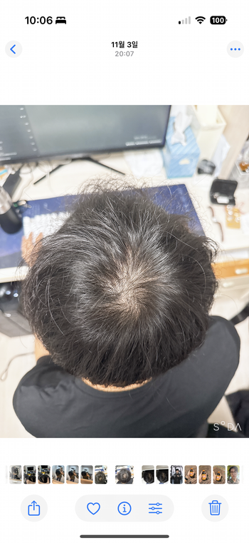 탈모 같나여 요 몇 달 사이에 좀 비어보이는디..