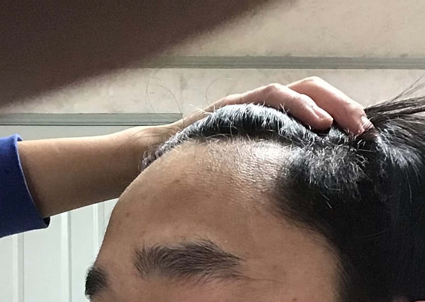 두상 때문에 이마도 더 넓어 보여..