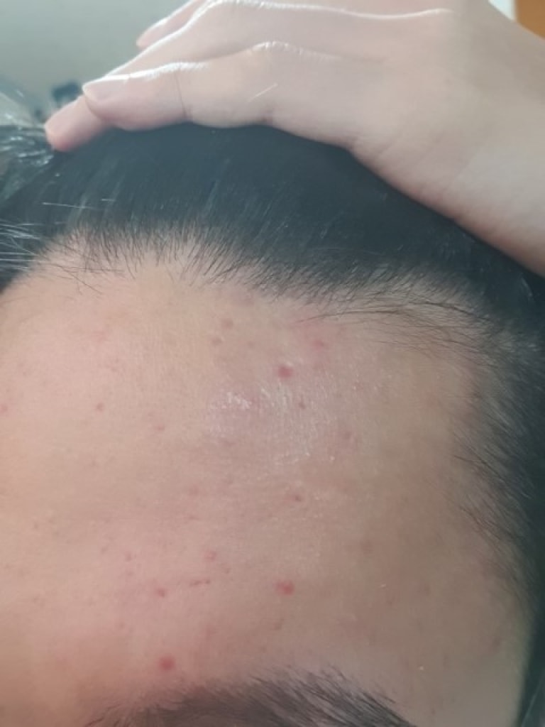 오른쪽 해어라인