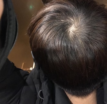 가마(2018년도 중순부터 복용하여 2월27일 자 사진)