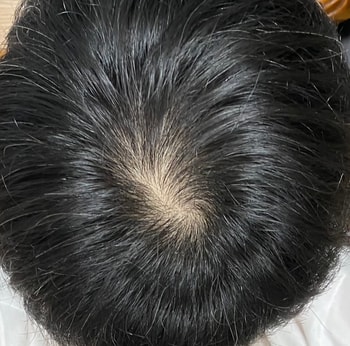 머리자른 후 7월 사진