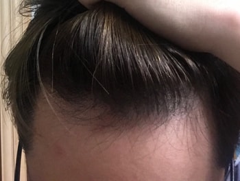 2년전 정면 윗측