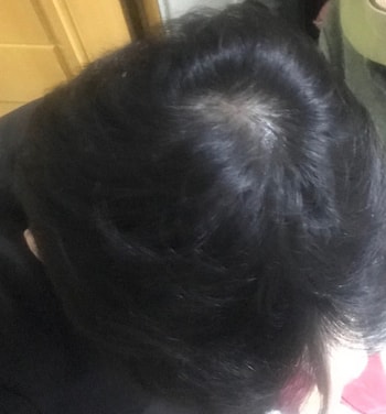 앙 정수리 롸잇나우띠