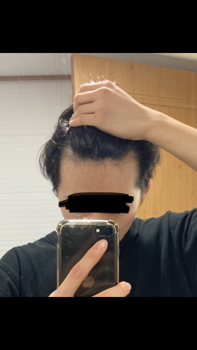 전
