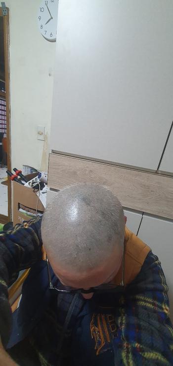 사이폴엔 1개월차