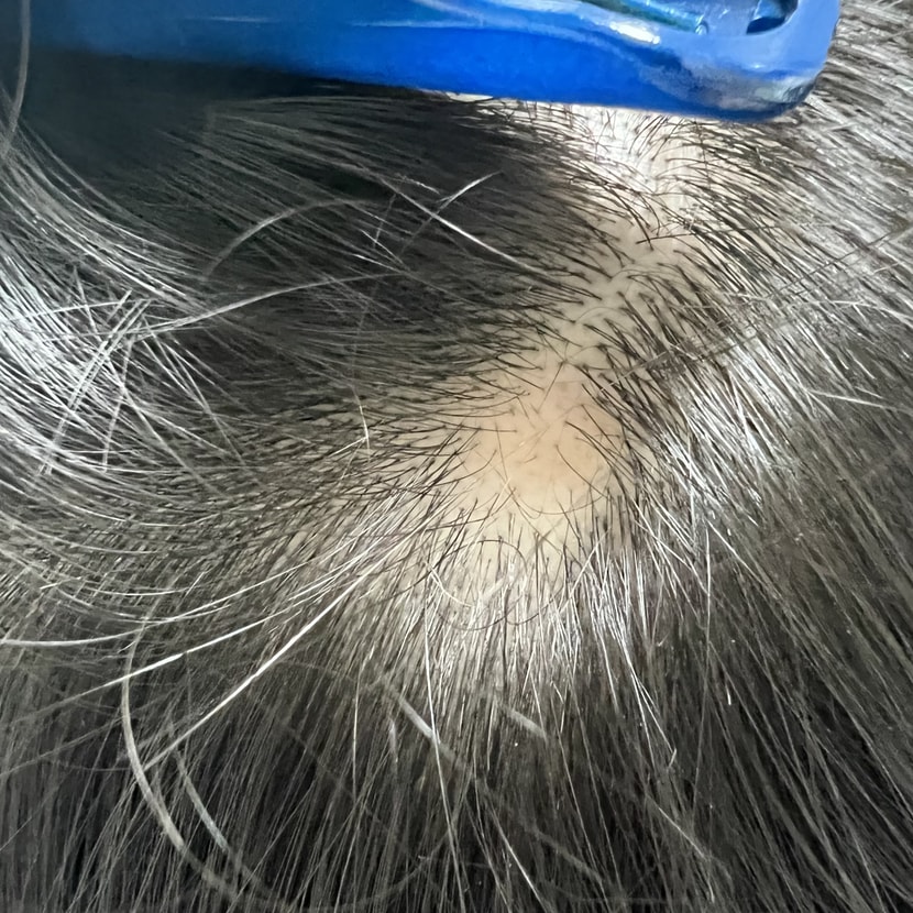 아래 글에 이어 하나 더 생겼네요 하핳